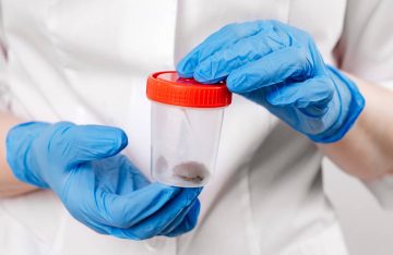 container in hand. collecting feces for analysis on helminths and protozoa container in hand.collecting feces for analysis on helminths and protozoa.mandatory studies for children and for hospitalization aimed at detecting parasites living in the lower gastrointestinal tract